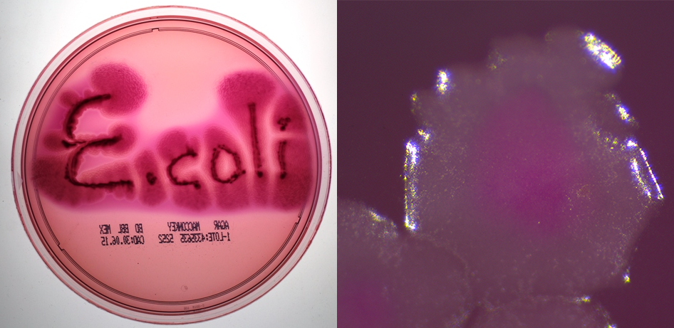 Coli sotwe. Среда Левина эшерихии. Escherichia coli на агаре Эндо.