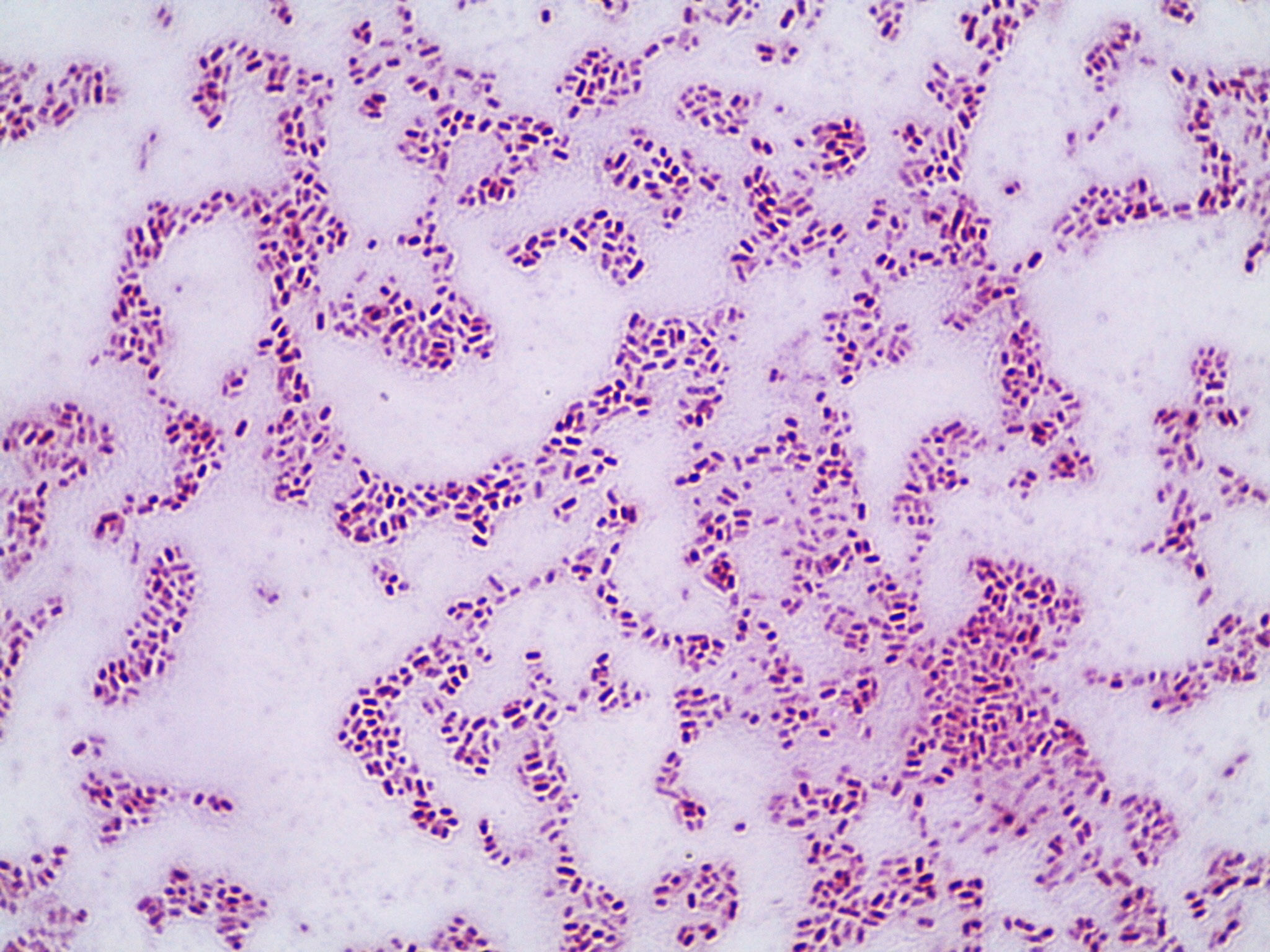 Микропрепарат бактерий. Klebsiella pneumoniae, «палочка Фридлендера». Клебсиелла пневмония микроскопия. Пневмококк клебсиелла. Клебсиелла пневмония под микроскопом.
