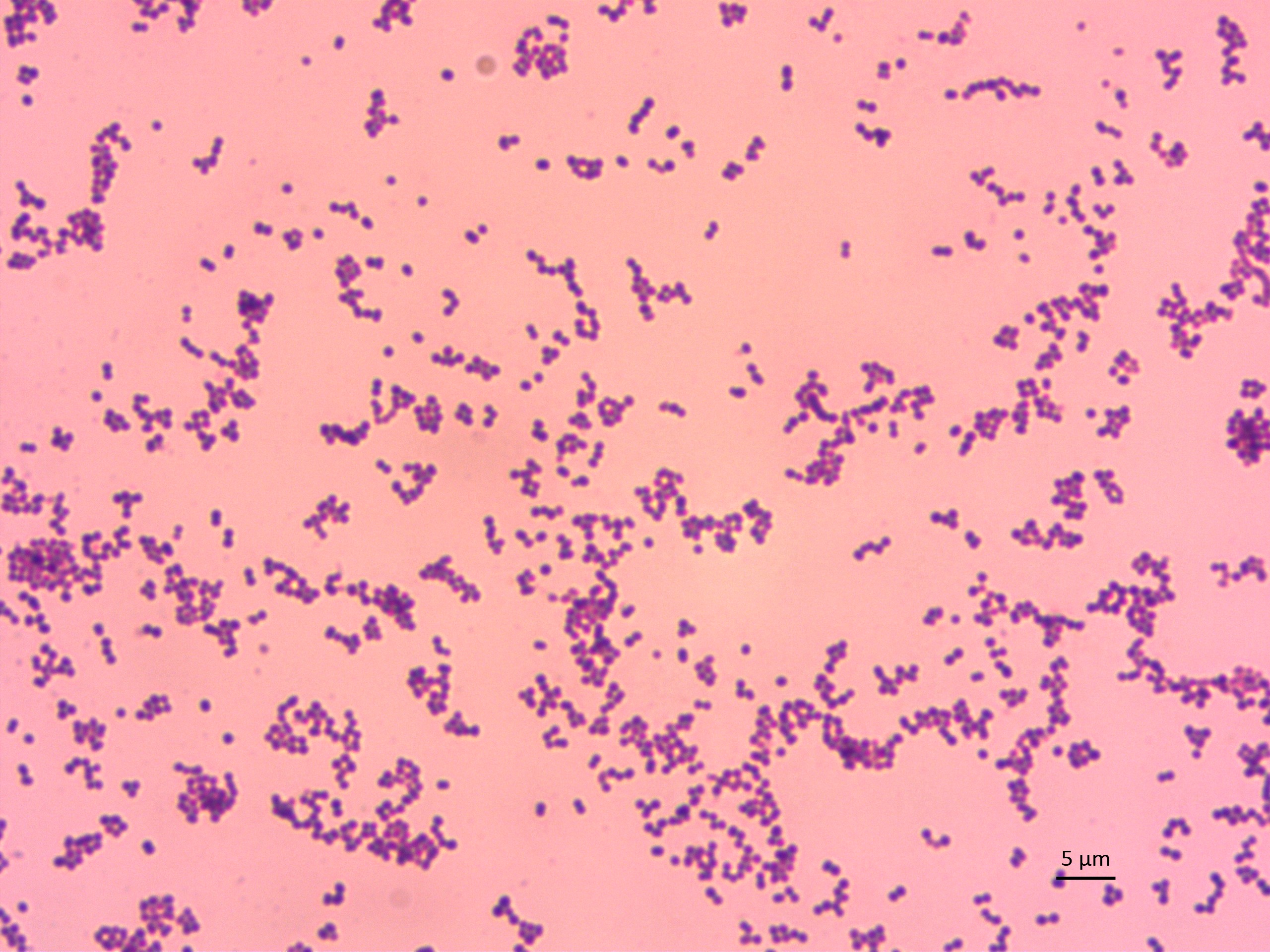 Pdf Identification Of Key Determinants Of Staphylococcus Aureus Vaginal Colonization